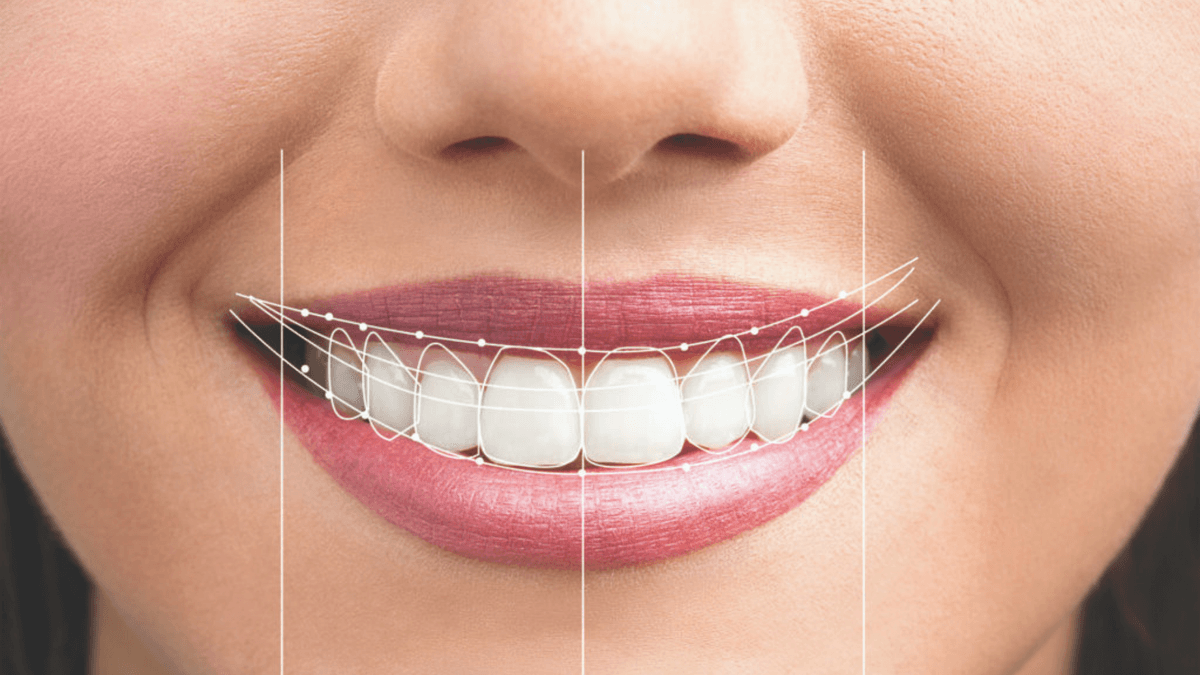 SmileDesign numérique