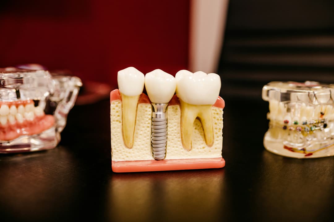 Équipe WeAligners